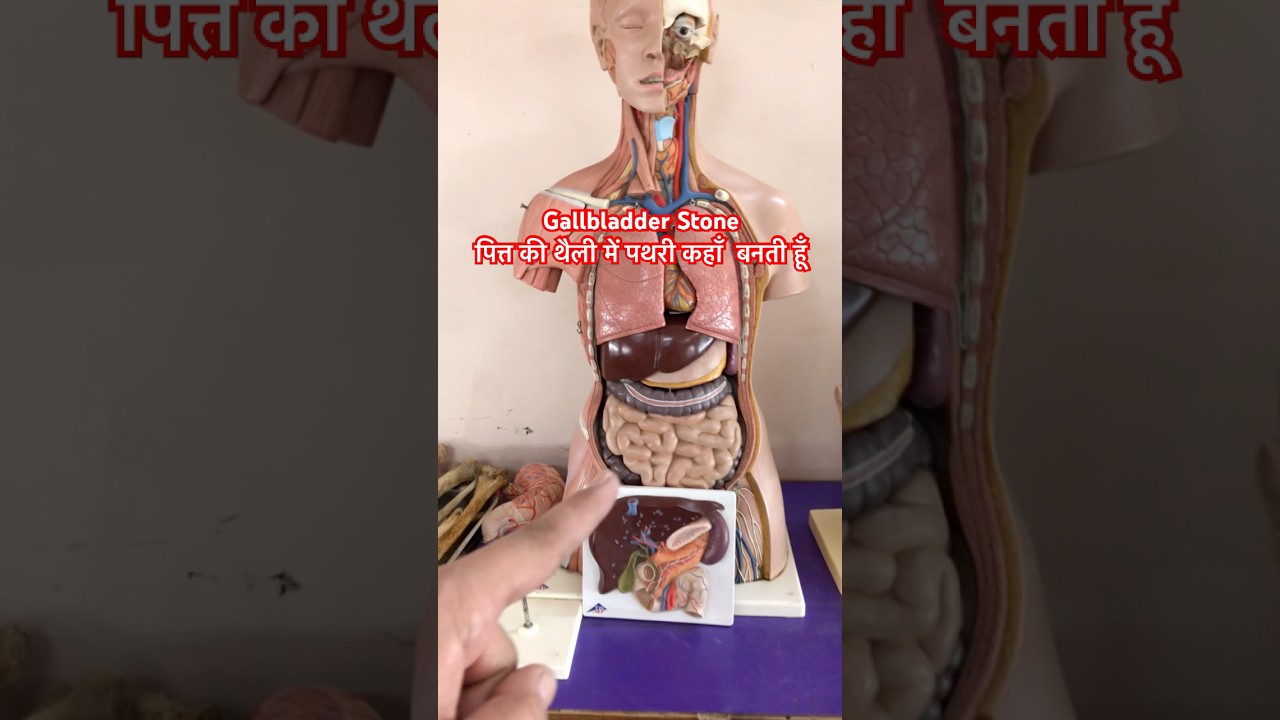 Gallbladder Stone | पित्त की थैली के अंदर पथरी कैसे और कहाँ बनती है #shorts