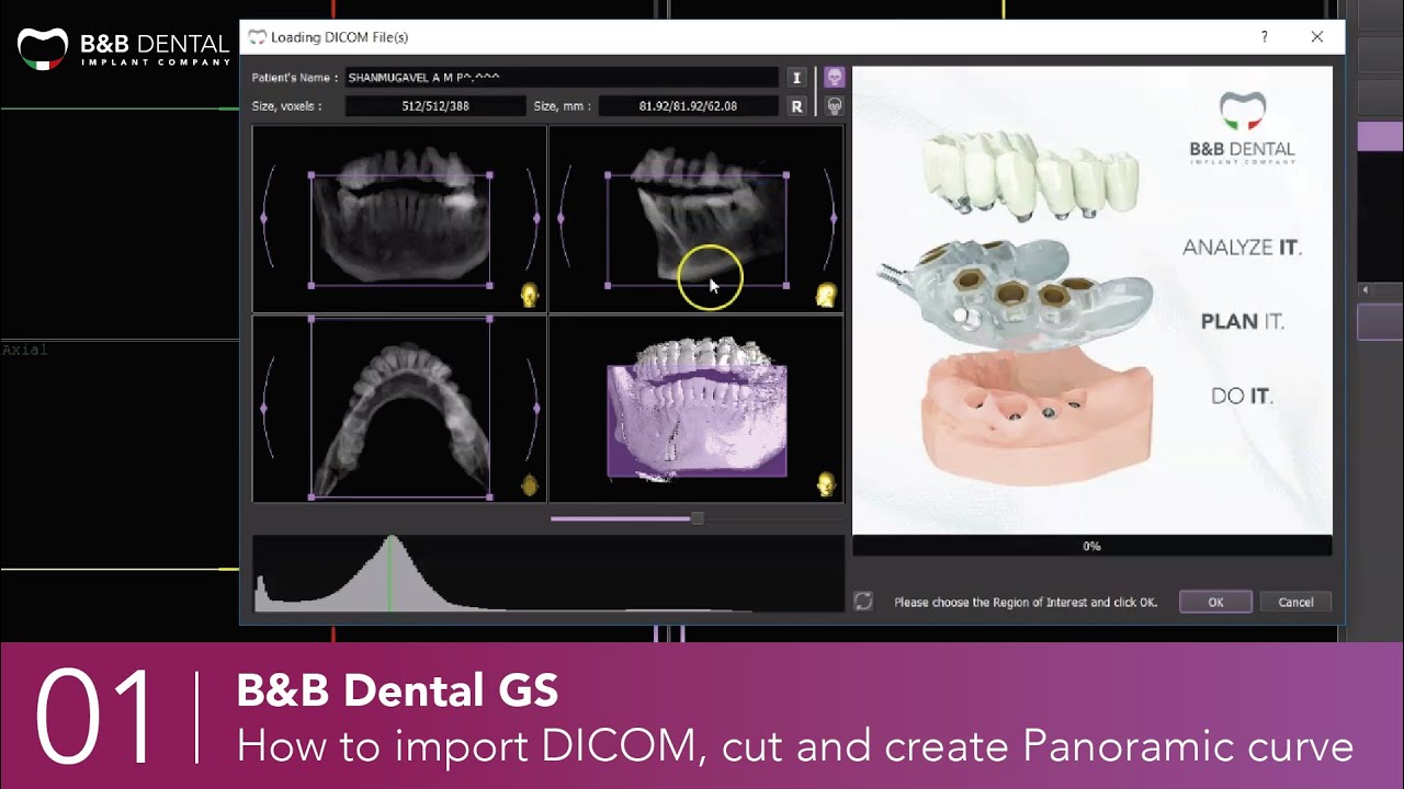 B&B Dental GS - 01 - How to import DICOM, cut and create Panoramic curve