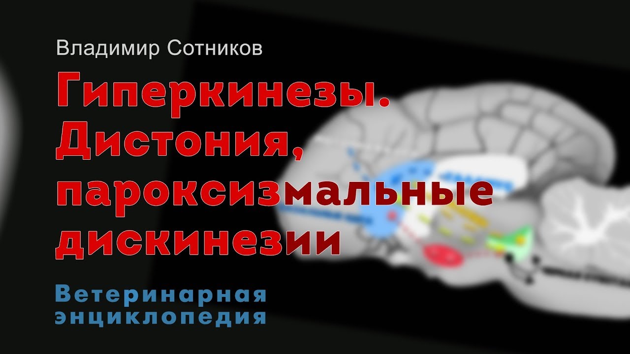 Гиперкинезы. Дистония, пароксизмальные дискинезии