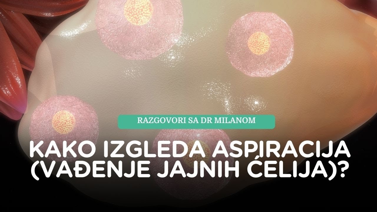 VTO: Aspiracija (vađenje jajnih ćelija)