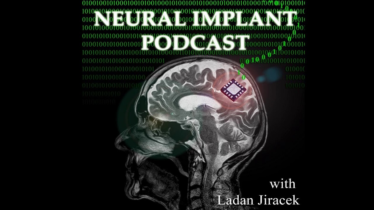 Dr Douglas Weber on his work at DARPA, neuroprosthetics, and bioelectronic medicine