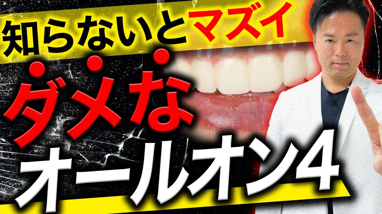 【知らないとマズい】ダメなオールオン４と良いオールオン４の違い