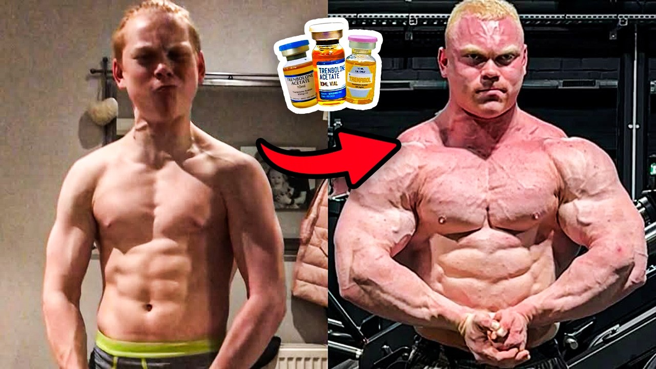 Этот бодибилдер, принимавший стероиды, совершил ОГРОМНУЮ ошибку в 21 год.