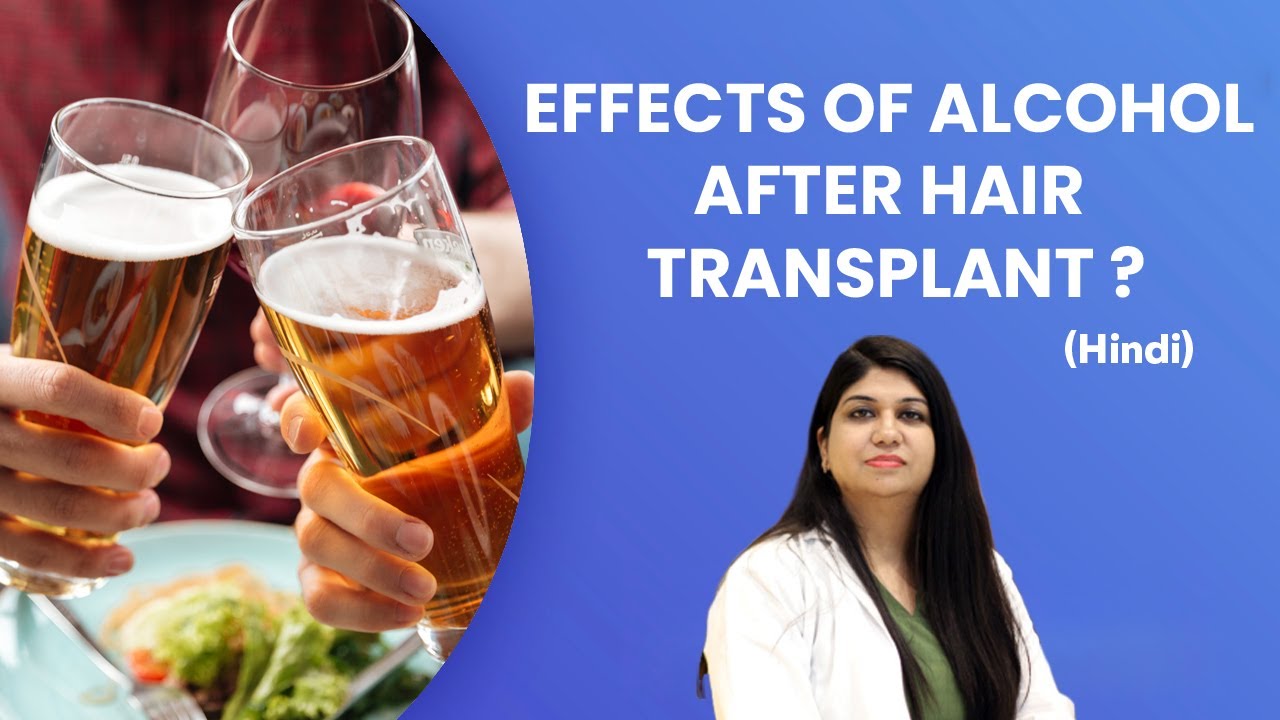 Effects Of Alcohol After Hair Transplant ?