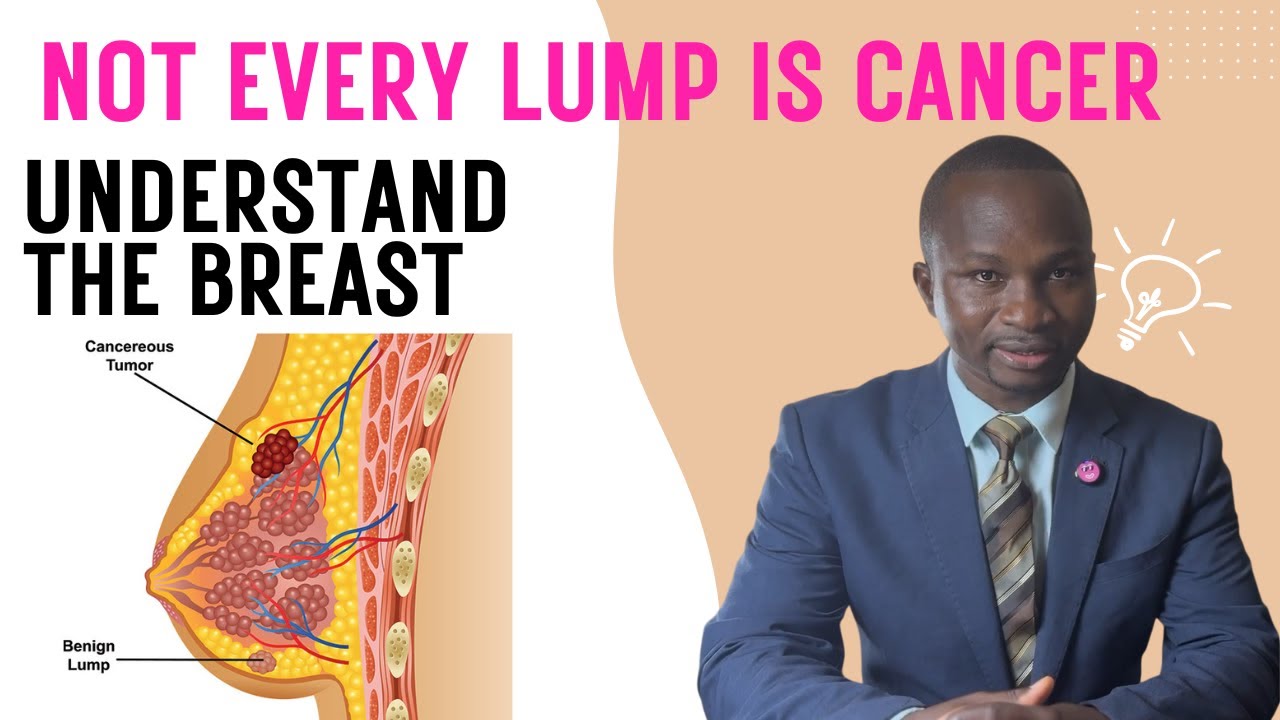 Not Every Lump Is Cancer | Understanding Benign and Malignant Breast Tumors