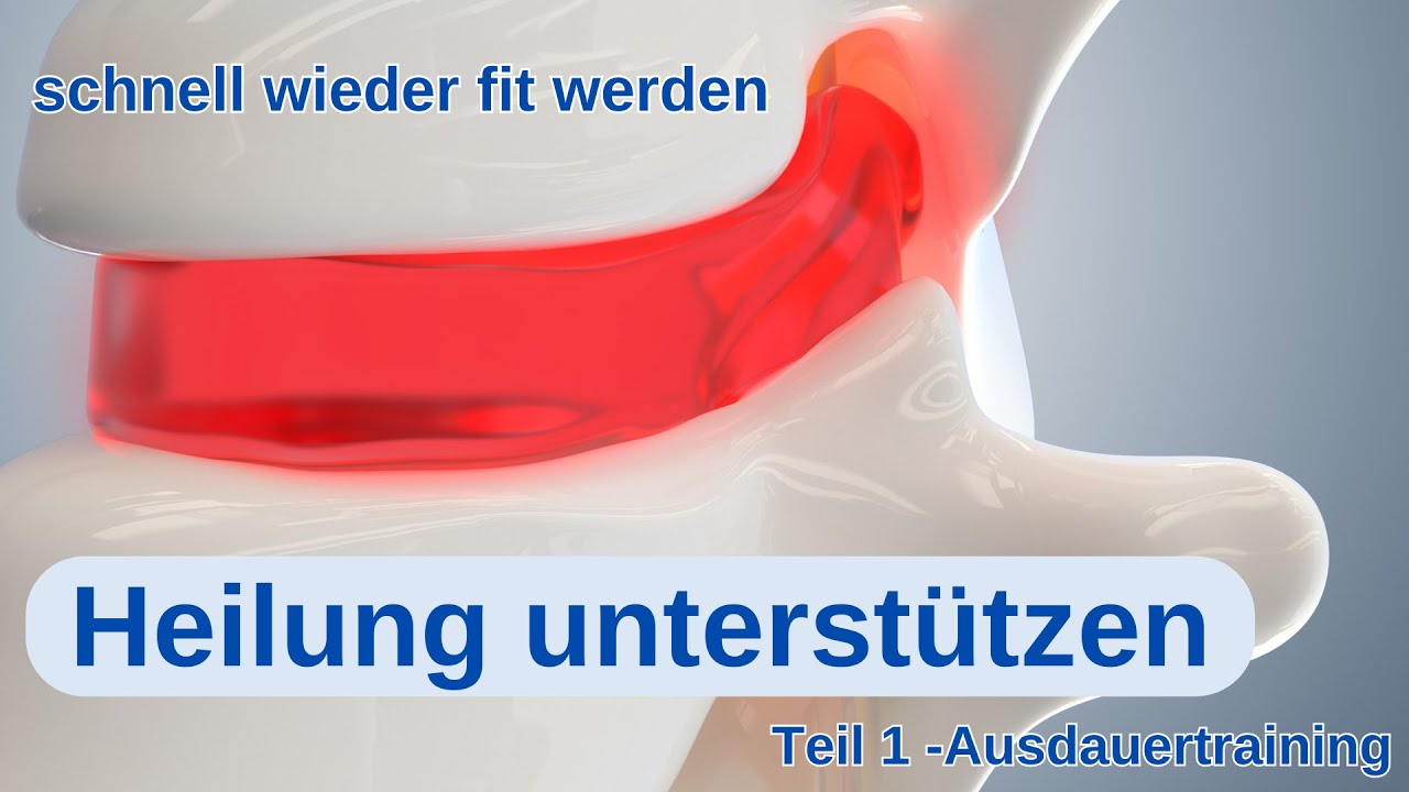 Trainingsplan nach Bandscheibenvorfall - Teil 1 (Ausdauertraining)