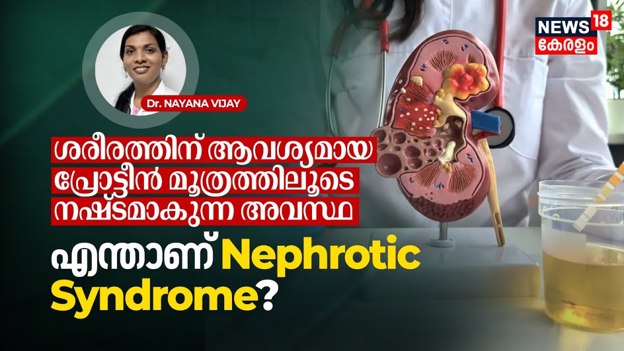 Dr. Q | ശരീരത്തിന്‌ ആവശ്യമായ പ്രോട്ടീൻ മൂത്രത്തിലൂടെ നഷ്ടമാകുന്ന അവസ്ഥ; Nephrotic Syndrome? | N18V