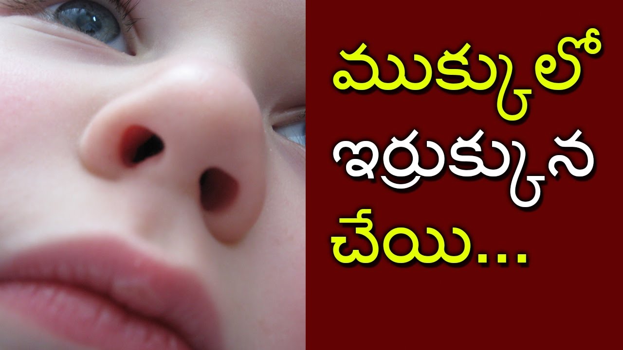 Nasal Congestion in Babies & Kids &ndash; Reason and 10 Home Remedies |HELLOTVNEWS