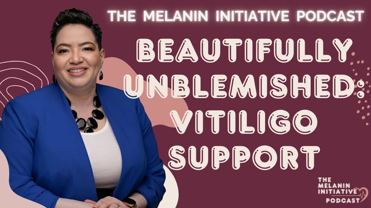 Building Support for Vitiligo: Beautifully Unblemished Community