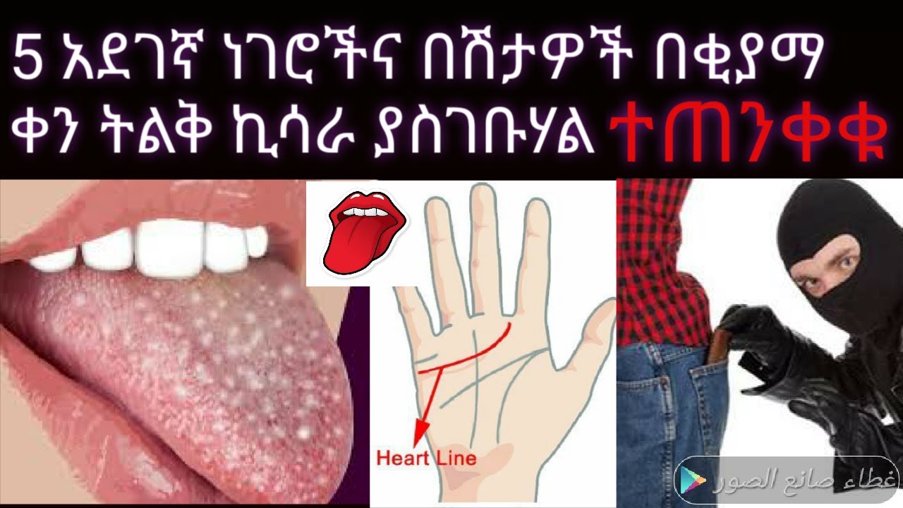እነዚህ 5 አደገኛ ነገሮችና በሽታዎች እና ሌሎችም በቂያማ ቀን ኪሳራ ያስገቡሃል  እንደሱ እንዳትሆኑ ተጠንቀቁ ዲንህን  እወቅ