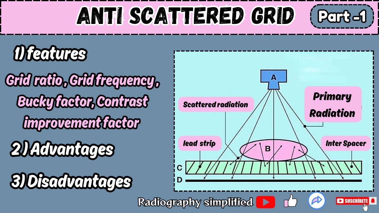Grid ( anti scattered)  l features , advantages & disadvantages l Radiography simplified