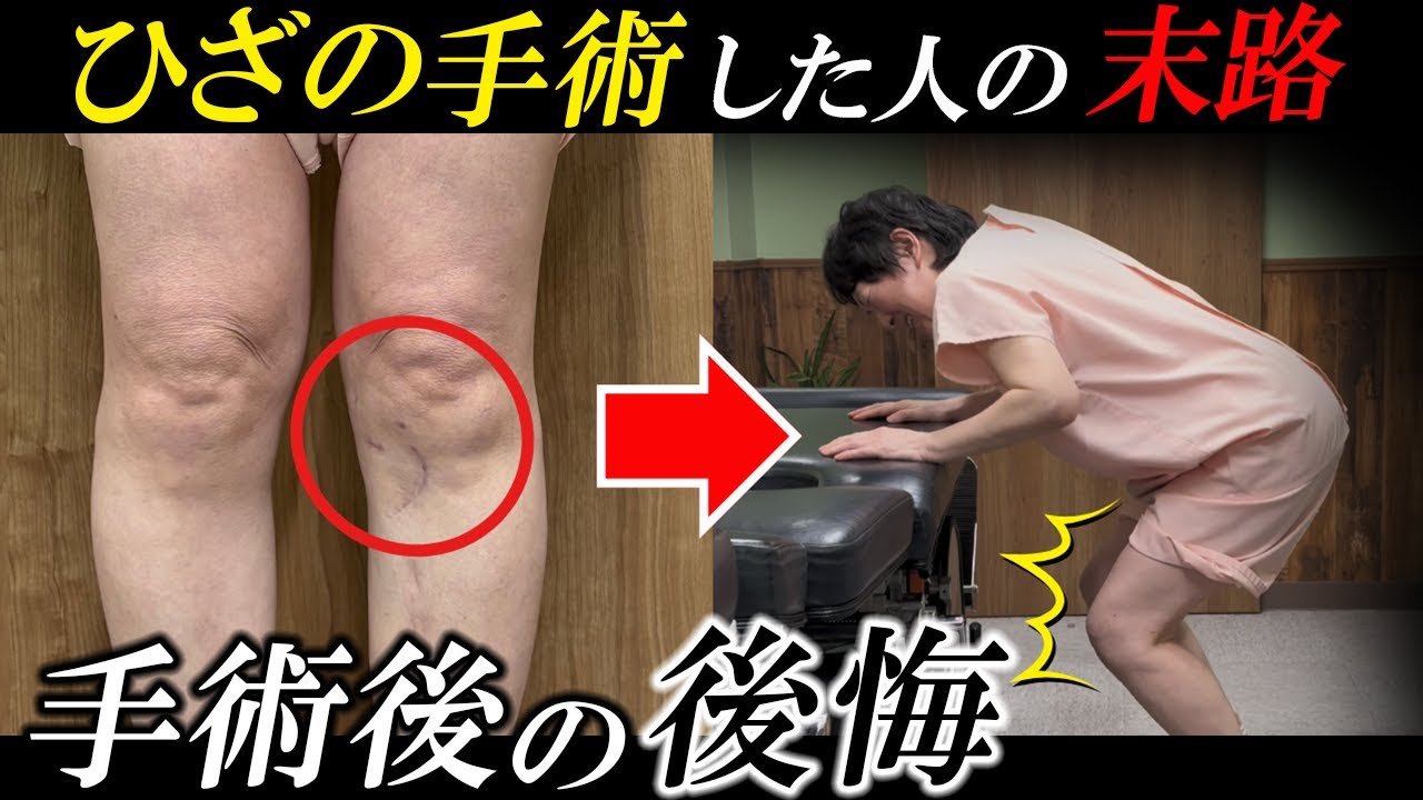 【※重症者向け】もっと早く知っていれば…ひざの手術“する前”に知っておいてほしいたった一つのこと【変形性膝関節症】