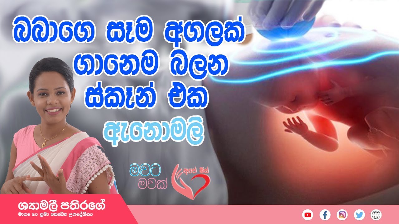 Anomaly Scan බඩ ඇතුලේ බබා සාමාන්‍ය ද බලන ස්කෑන් එක| Shyamalee Pathirage