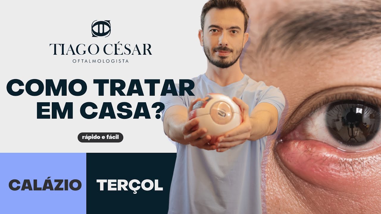 Calázio ou Terçol no Olho: Como tratar e curar em casa? DESCUBRA AGORA