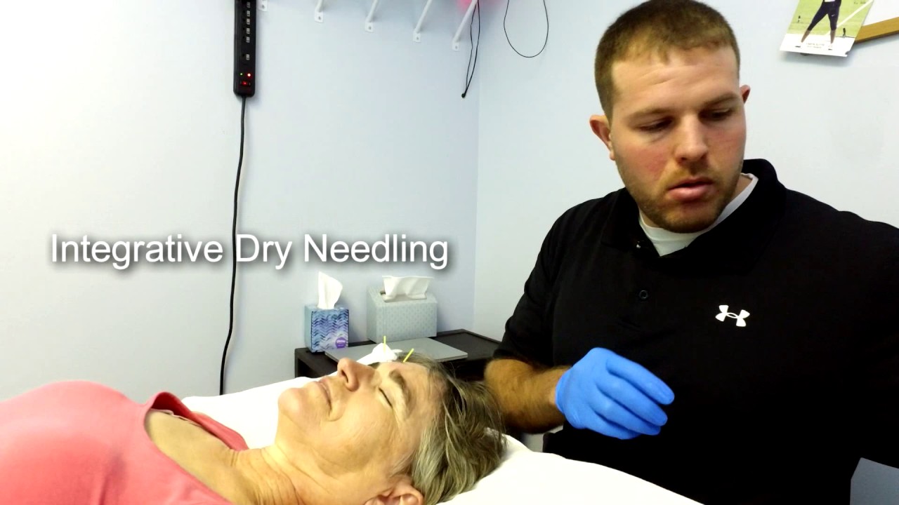 Cervical Dystonia and Integrative Dry Needling.