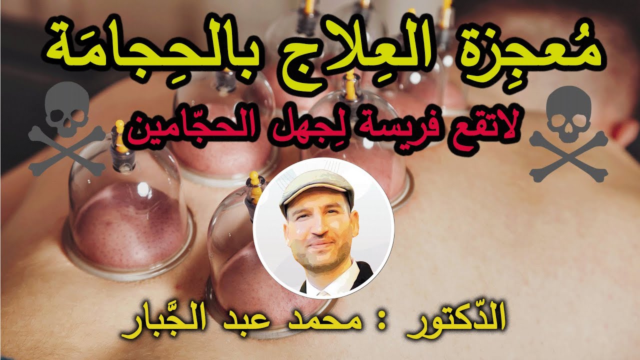 فوائد الحجامة الطبية والعلاجية التي لا يعلمها الأطباء ولا الحجامون ( الجزء الأول )