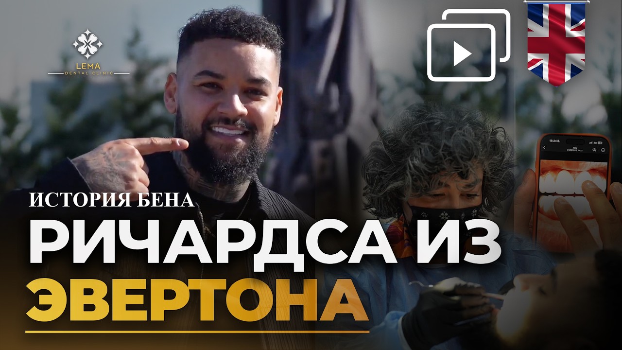 Зубы Бена Ричардса-Эвертона: Бен сейчас в клинике Lema – Турция!