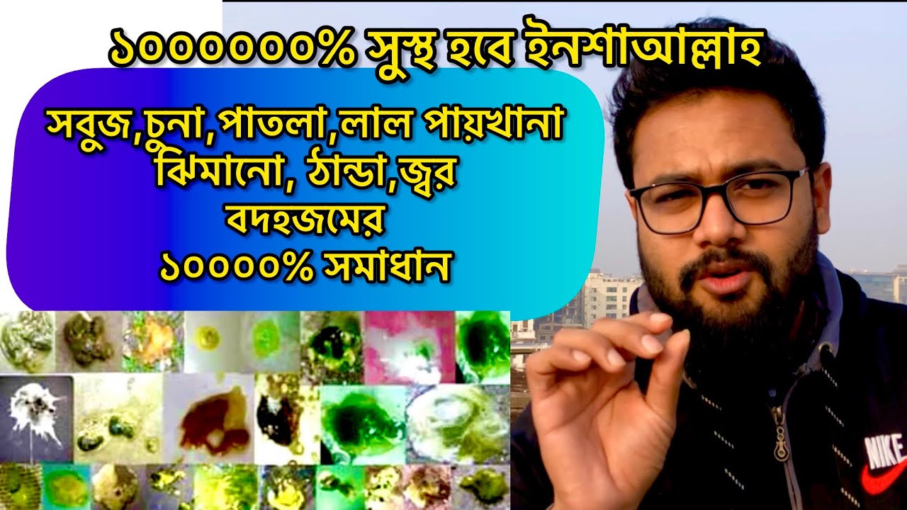 কবুতর সবুজ চুনা হলুদ পাতলা পায়খানা করলে , বমি করলে ঝিমালে কি চিকিৎসা দিবেন? #সবুজপায়খানা