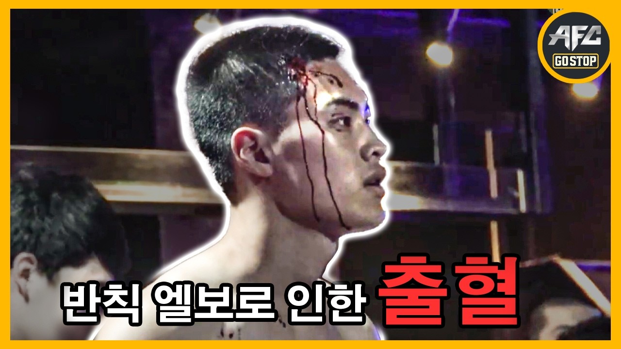 엘보 반칙으로 인한 유혈 사태 발생! 이대로 경기는?