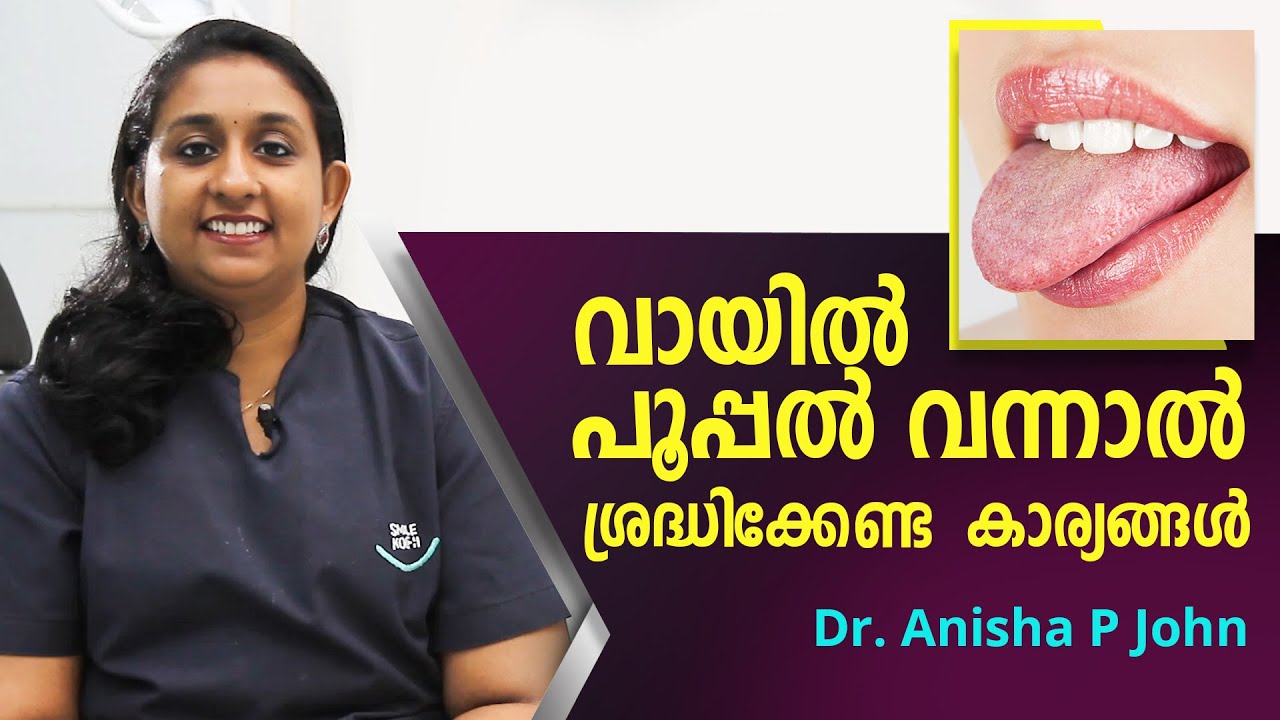 വായിൽ പൂപ്പൽ വരുന്നതും ശ്രദ്ധിക്കണ്ടതും Dr. Anisha | Health Tips | L Bug Media