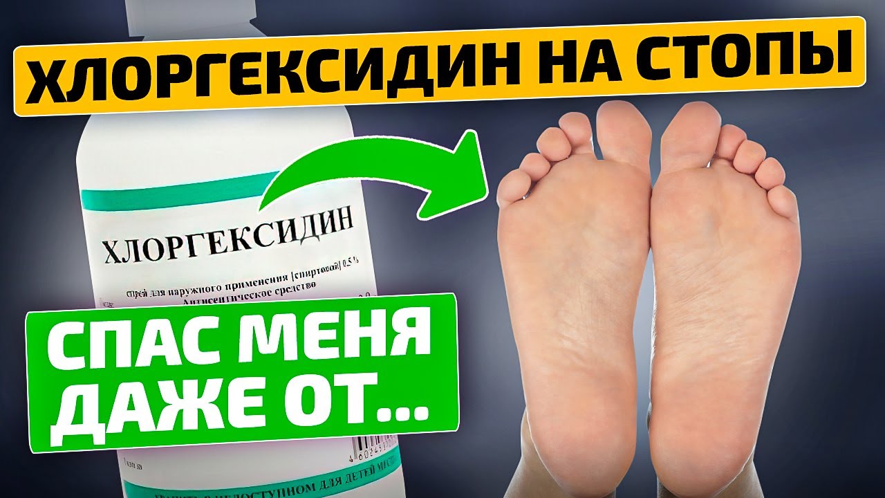 Лечит ноги и болезни - Хлоргексидин!