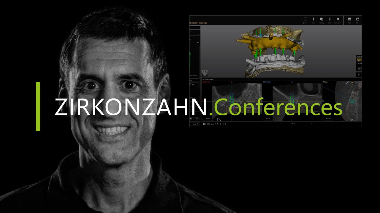 From implant planning to immediate loading in the digital age | Zirkonzahn.Conferences