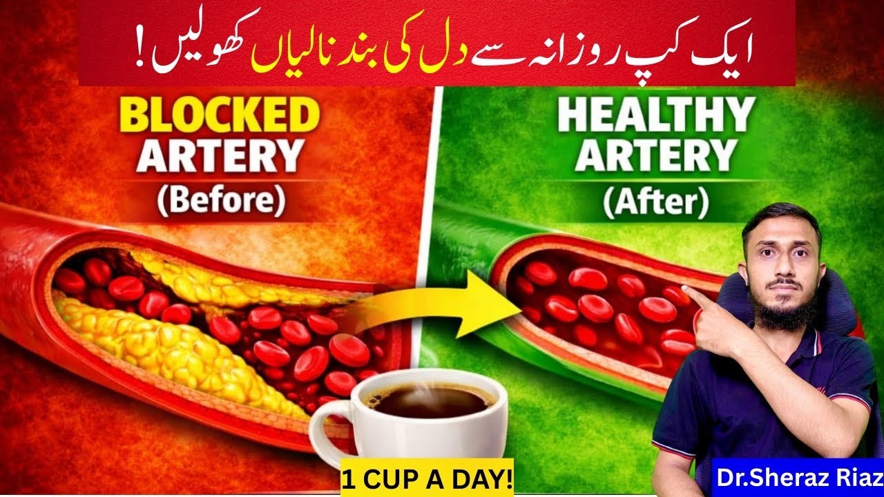NATURAL REMEDY : Clear Blocked Arteries FAST - Blocked Arteries Treatment?