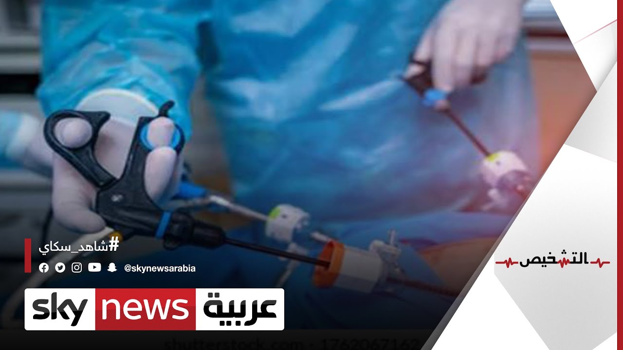 أحدث تقنيات شفط الدهون | #برنامج_التشخيص