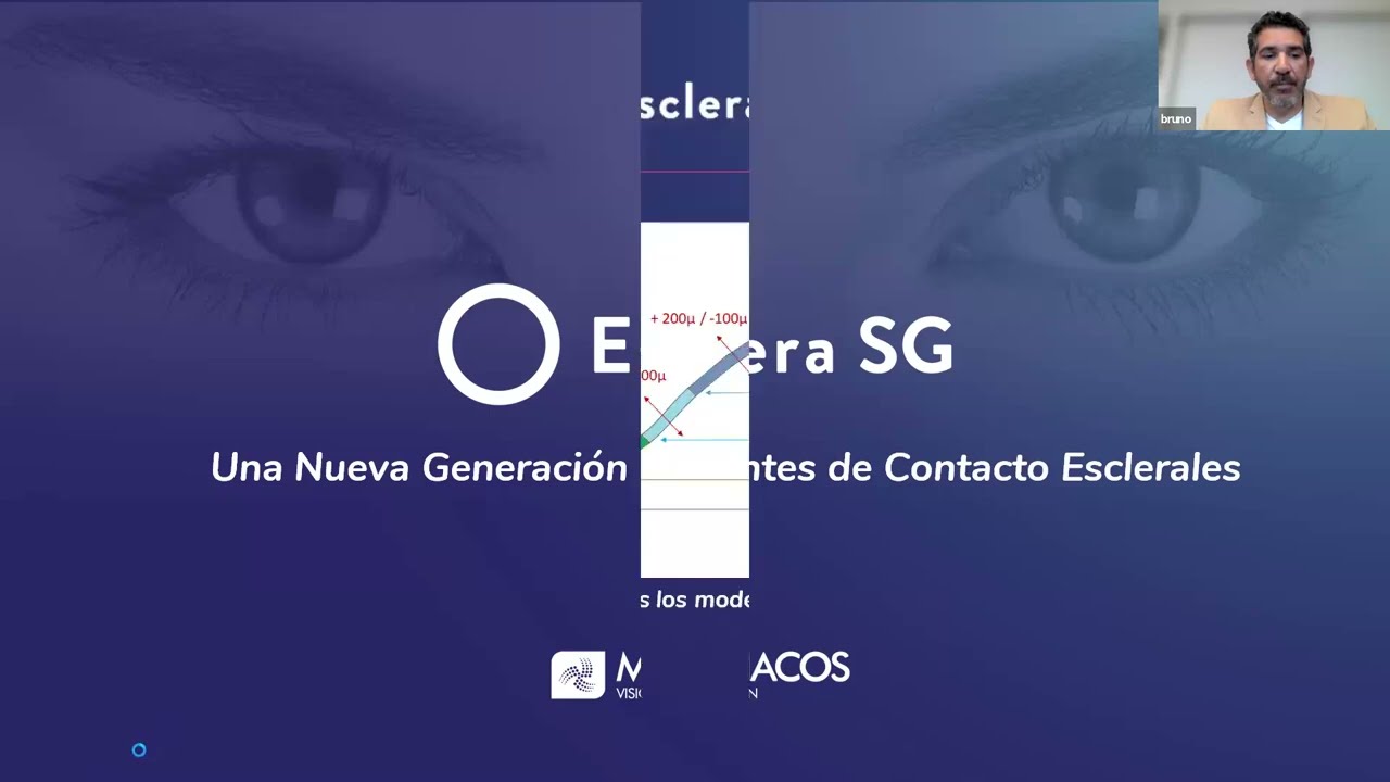 Esclera SG con Bruno Lima