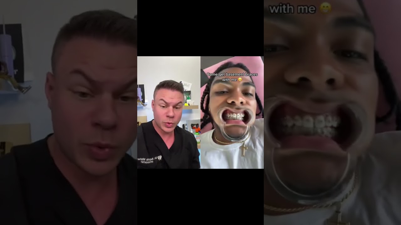 Man Gets Braces In A Basement