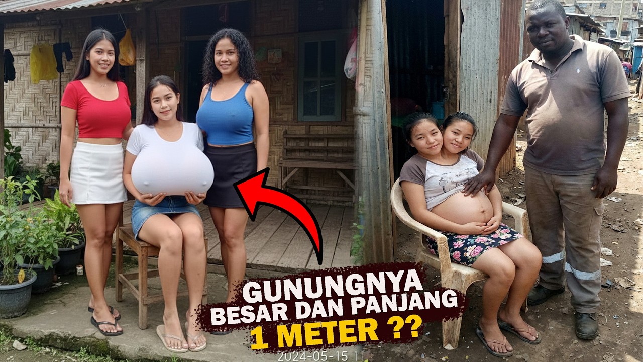 VIRAL DAN HEBOH !! 7 Kisah Manusia dengan Kondisi Paling Langka di Dunia!!