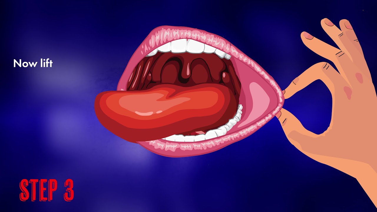 Mouth Self Examination Animation