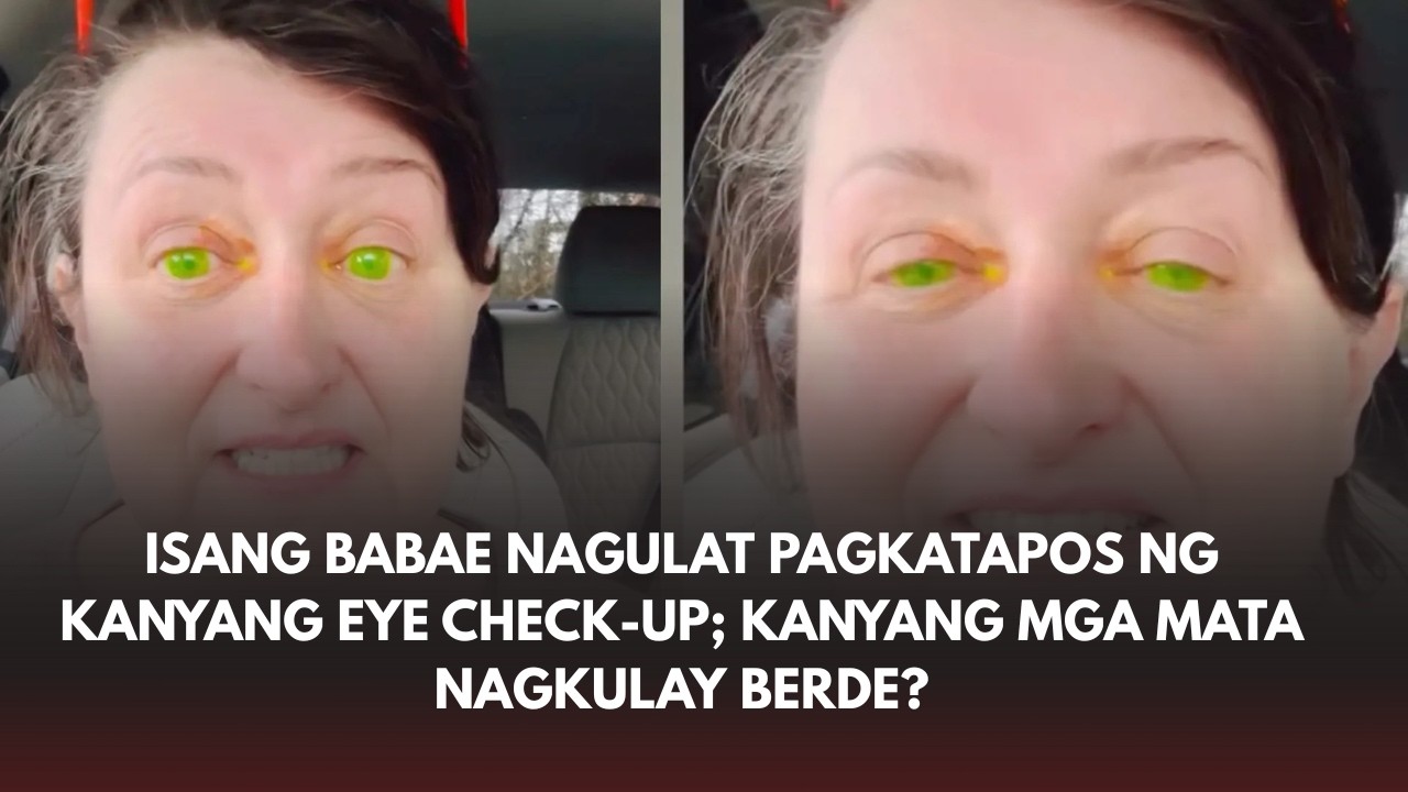 Isang babae nagulat pagkatapos ng kaniyang eye check-up; kaniyang mga mata, nagkulay berde?
