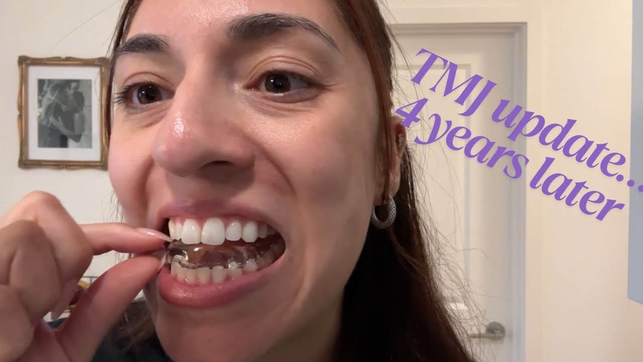 TMJ update… 4years later.