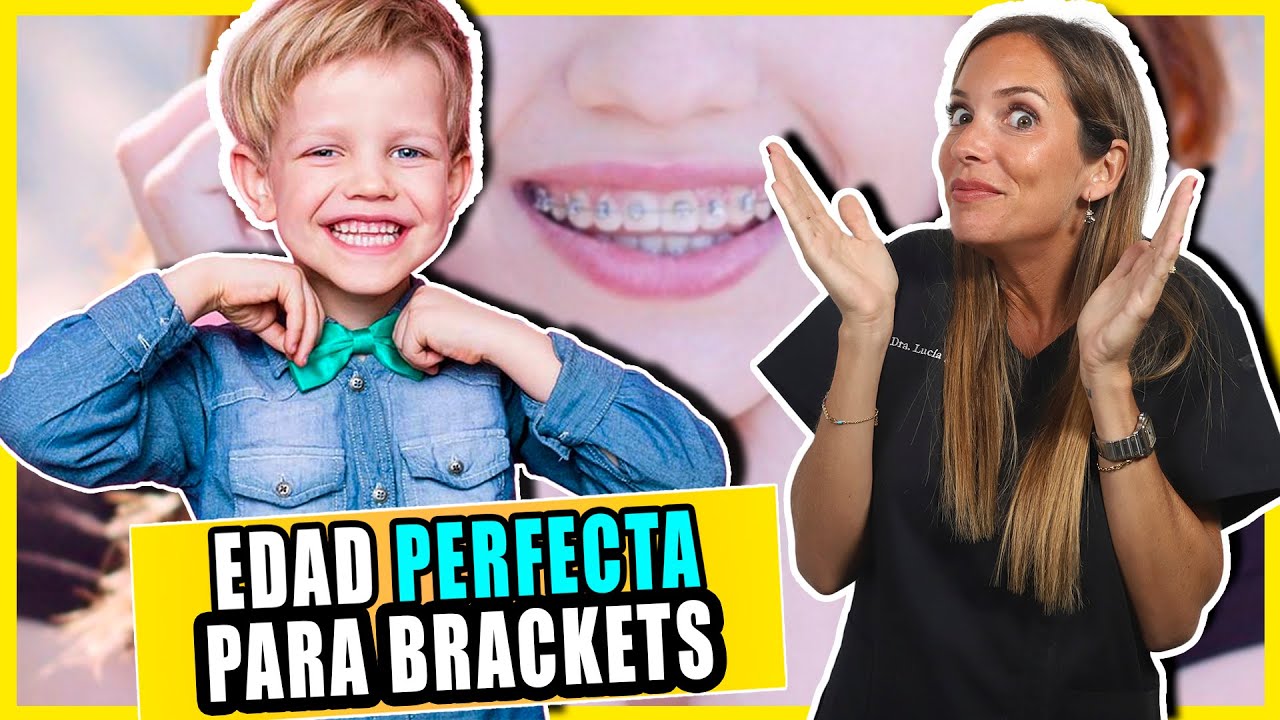 👉¿A que EDAD se COLOCAN los BRACKETS? -  Descubre Para que sirve LA ORTODONCIA (Te sorprenderá 😲)