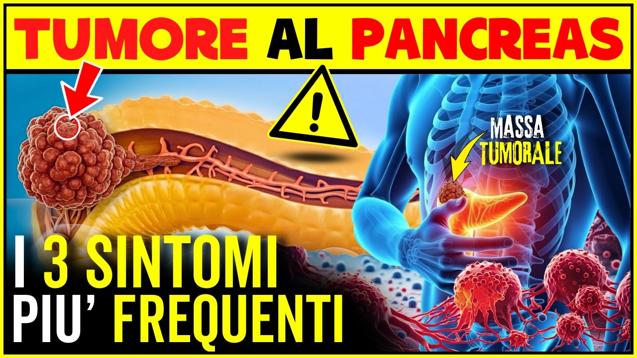 TUMORE AL PANCREAS: I 3 Sintomi Più Frequenti
