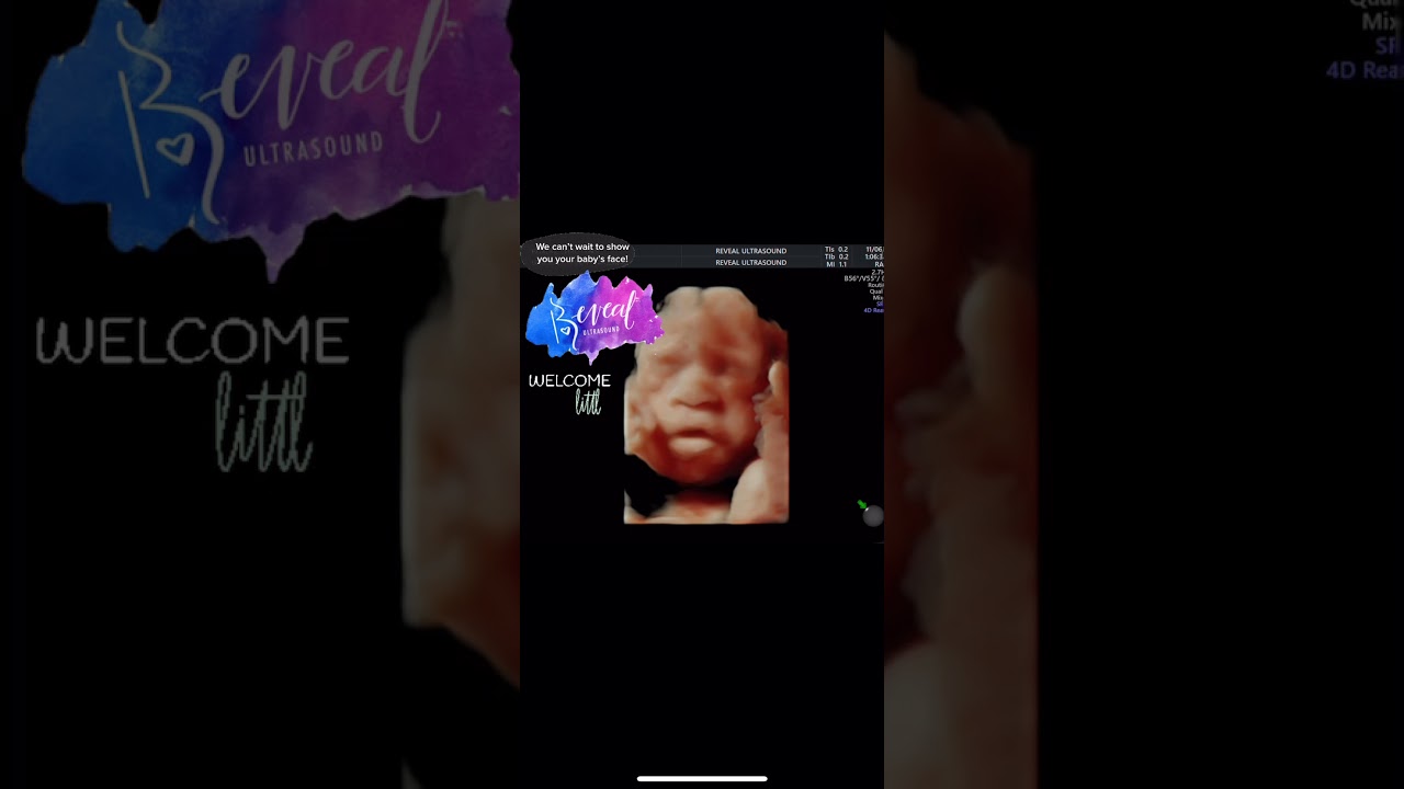 NOW AVAILABLE! Live-stream your elective ultrasound anywhere in the world via private link!