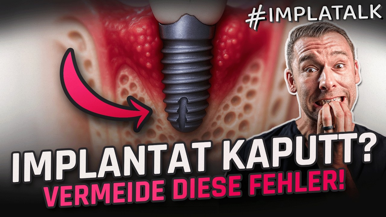Implantate richtig pflegen &ndash; Dein ultimativer Guide