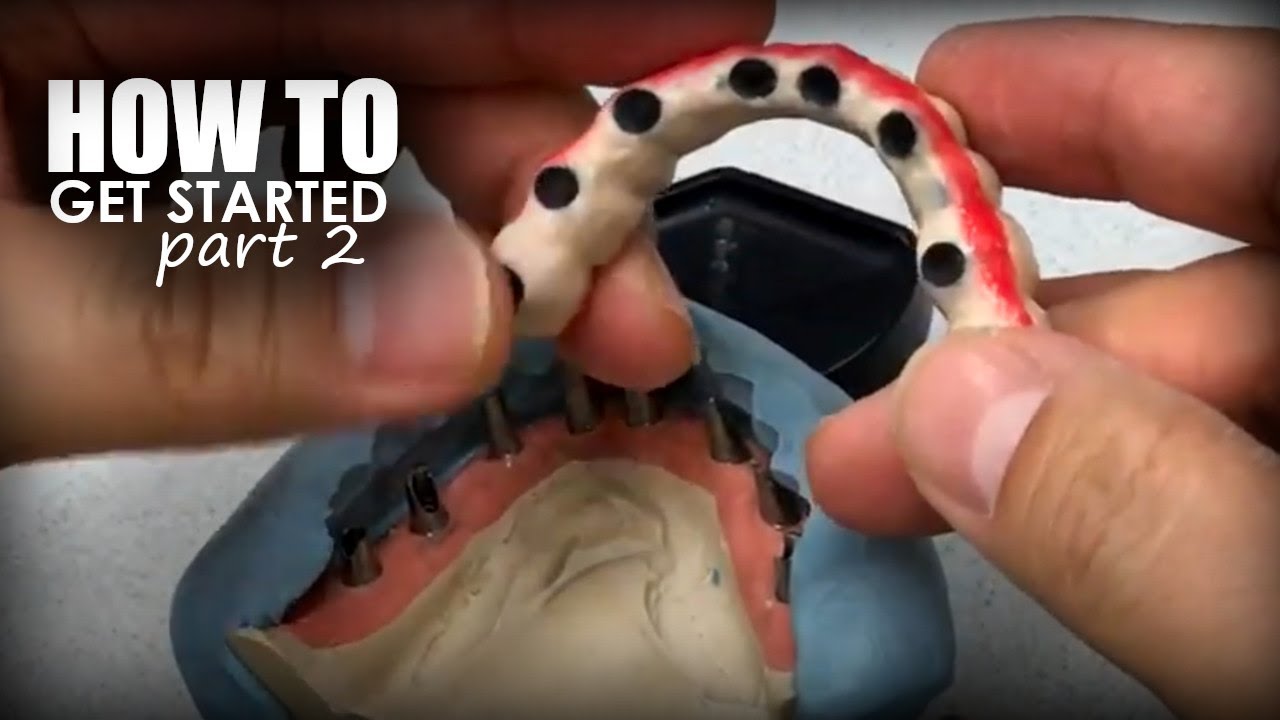 How to Start a Full-Mouth Case with Multiple Restoration Types, pt.2
