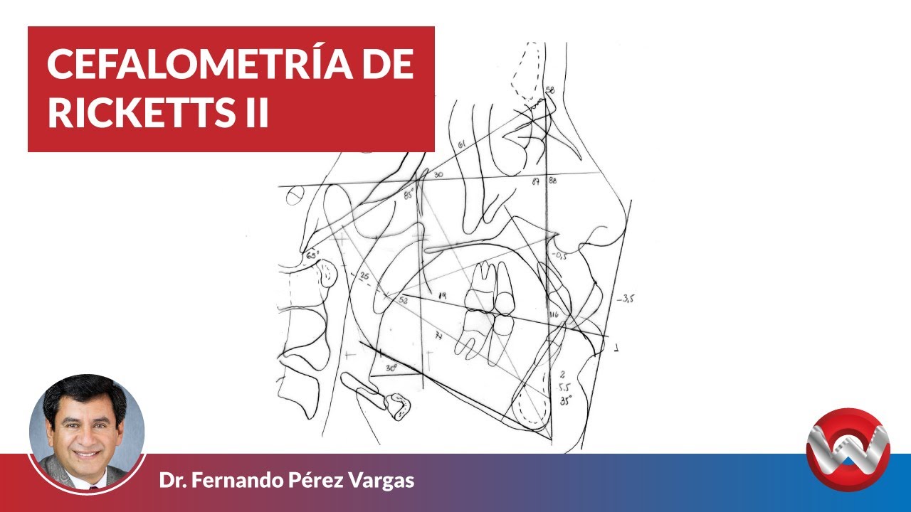 Cefalometría de Ricketts II