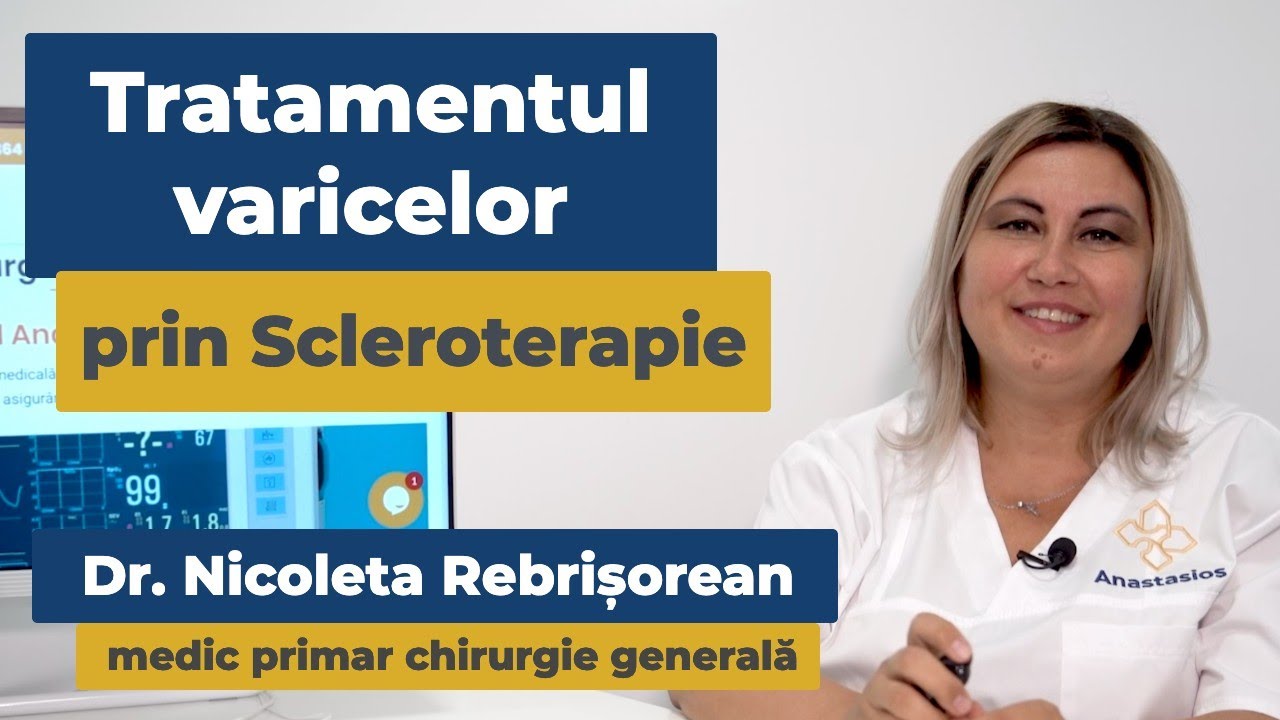 Scleroterapia în tratamentul varicelor (boala venoasă cronică)