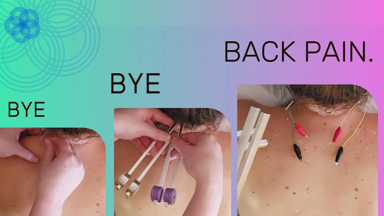 BYE BYE BACK PAIN! - Acupuncture, Electro-Stim, & Zodiac Tuning Forks for Lasting Relief!