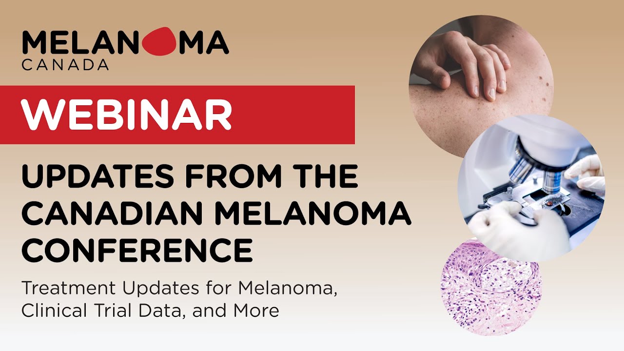 Updates from the Canadian Melanoma Conference, presented by Dr. Marcus Butler, MD