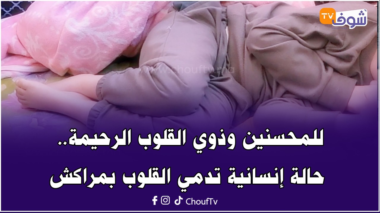 يحيى طفل كفيف وعندو مشاكل في النمو و كيحتاج مصاريف باهضة شهريا والأسرة تعيش الفقر الشديد