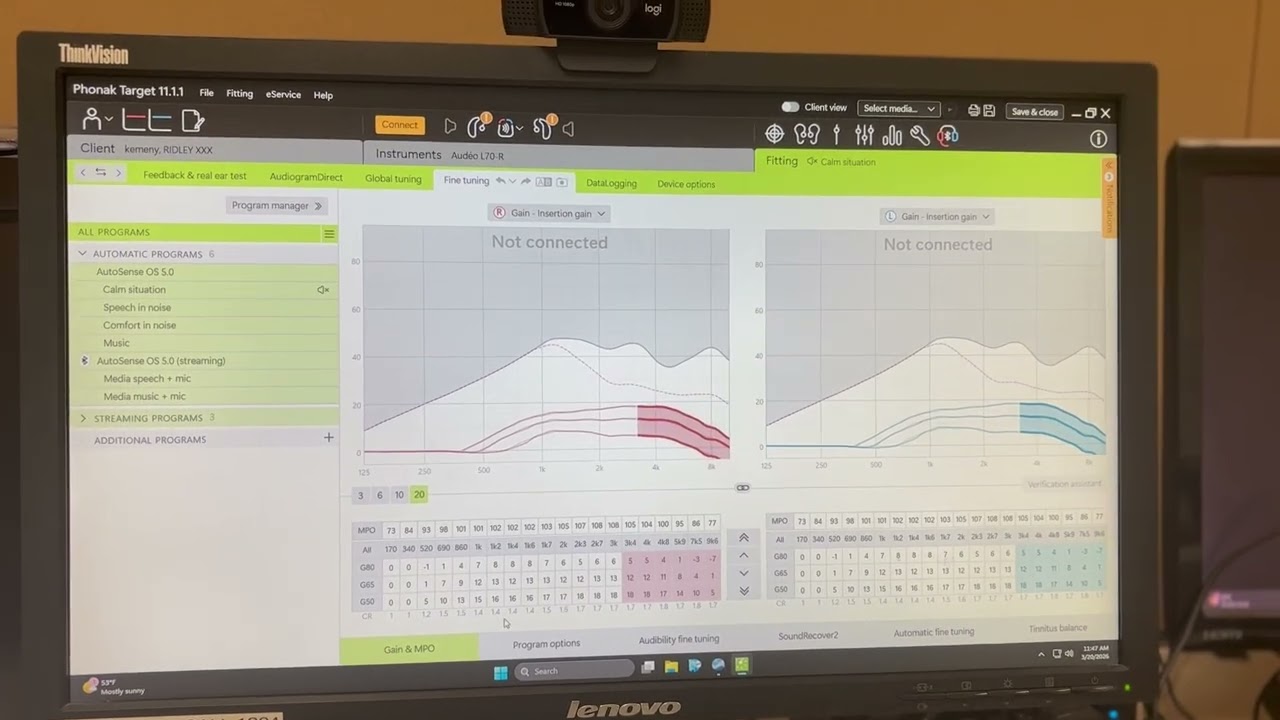 Preprogramming Phonak
