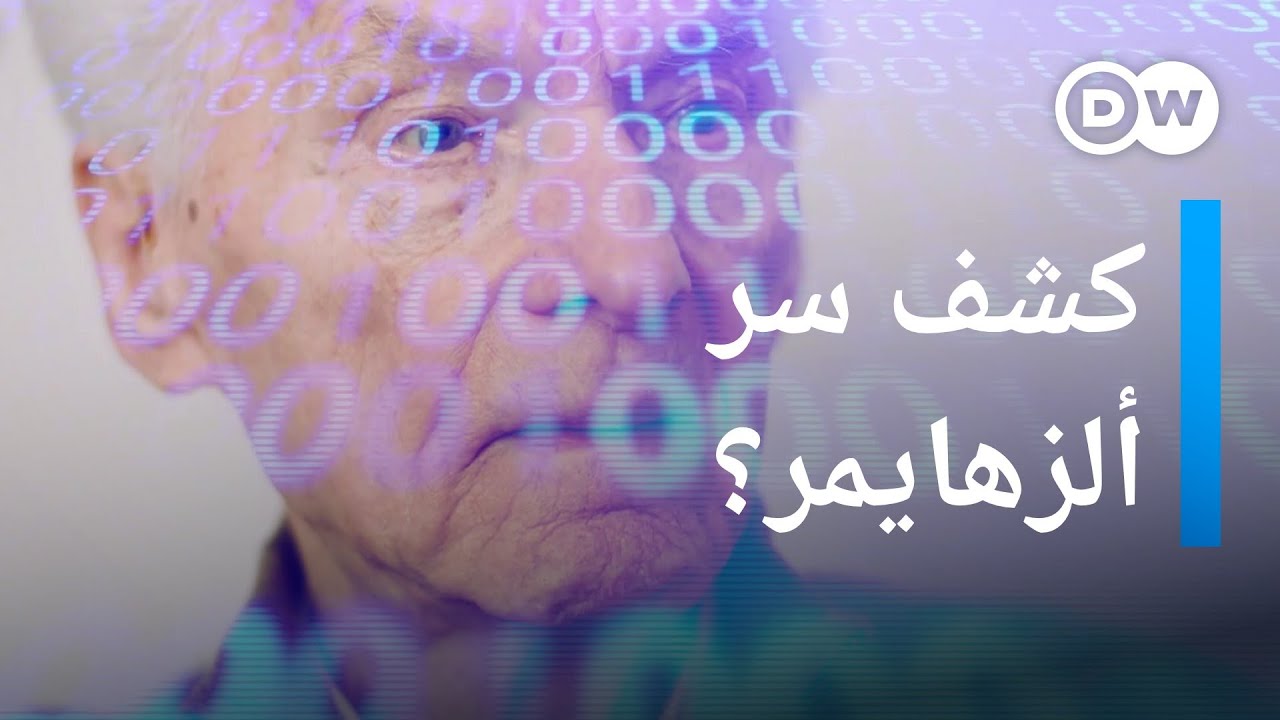 الذكاء الاصطناعي يساهم في علاج ألزهايمر  | كليك