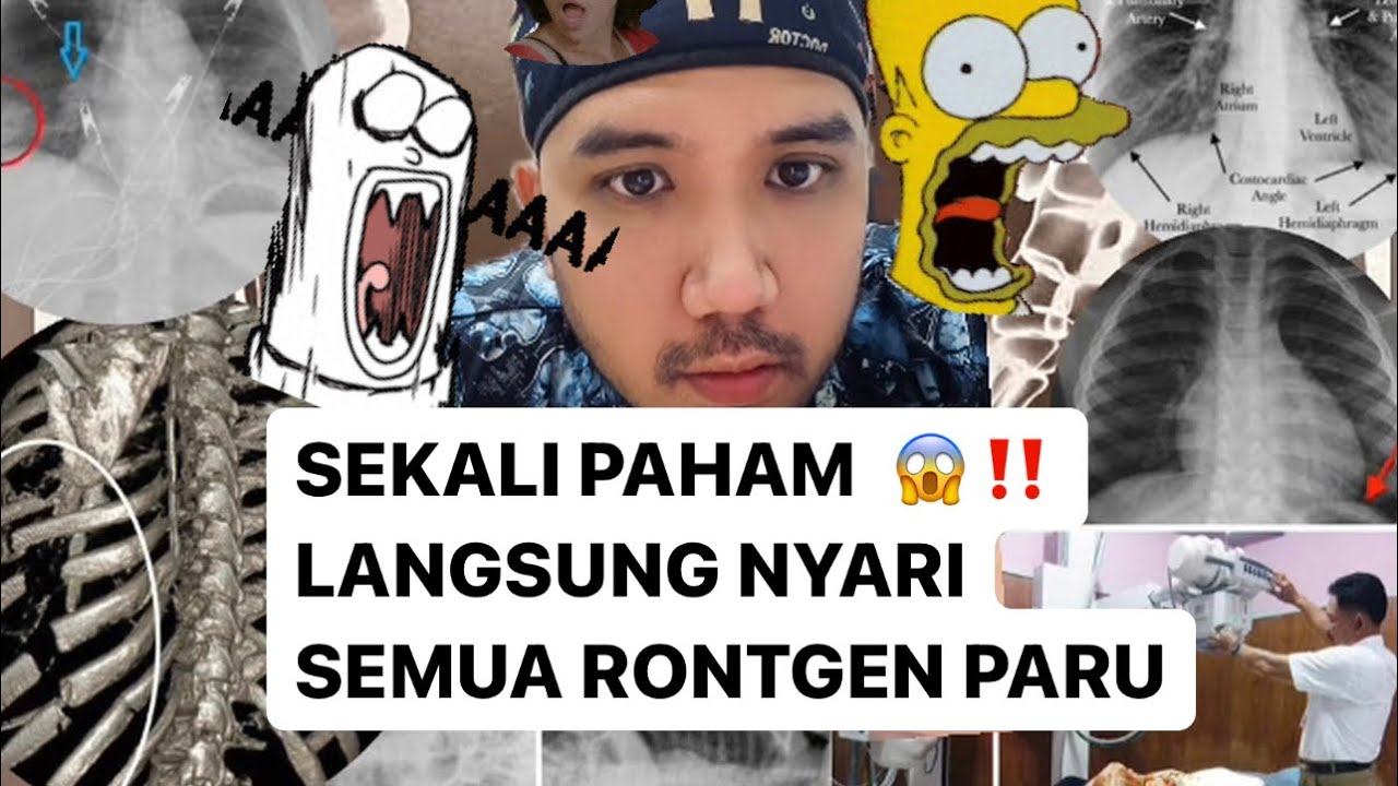 CARA MEMBACA RONTGEN PARU / THORAX ‼️ HAPAL SAMPAI KAPANPUN 😱😱