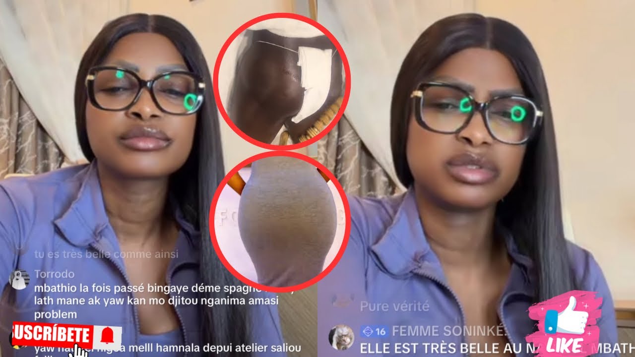 Mbathio Donne Son Avis sur La Chirurgie Des C&eacute;l&eacute;brit&eacute;s au S&eacute;n&eacute;gal &laquo;&nbsp; s&eacute;ne forme you niaw&nbsp;&raquo;