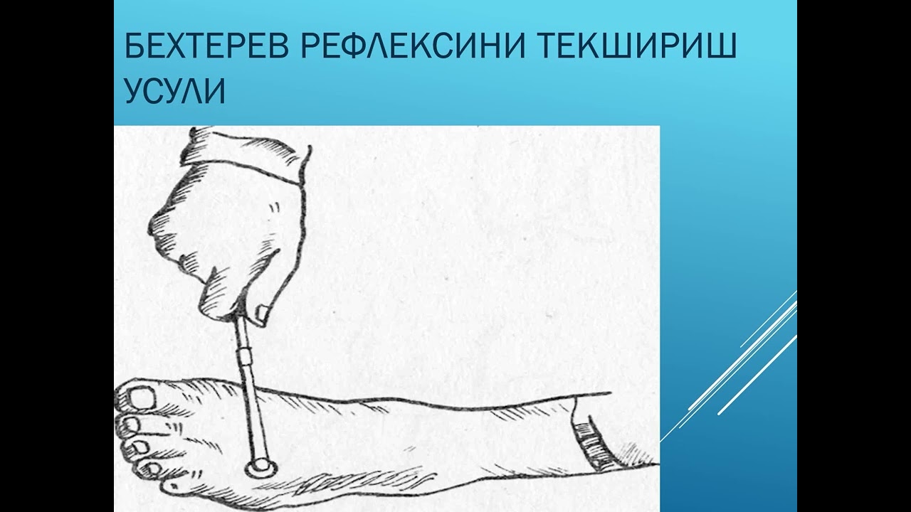 Ixtiyoriy harakat tizimi zararlanish sindromlari