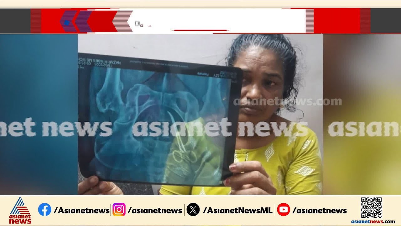 ശസ്ത്രക്രിയ ഉപകരണം രോഗിയുടെ വയറിൽ മറന്നുവച്ചതിന് ഡോ. ലളിതാംബിക കരുണാകരനെതിരെ കേസ്